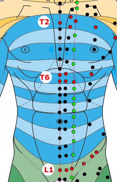 On dermatomes, meridians and points: results of a quasiexperimental study