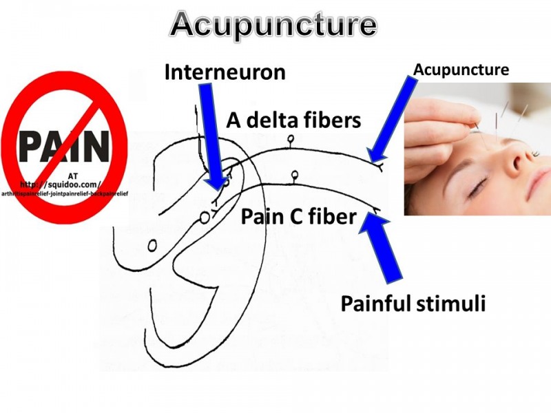 New Scientific Breakthrough Proves Why Acupuncture Works