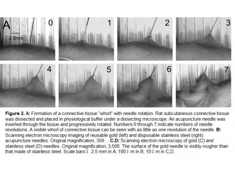 Relationship of acupuncture points and meridians to connective tissue planes