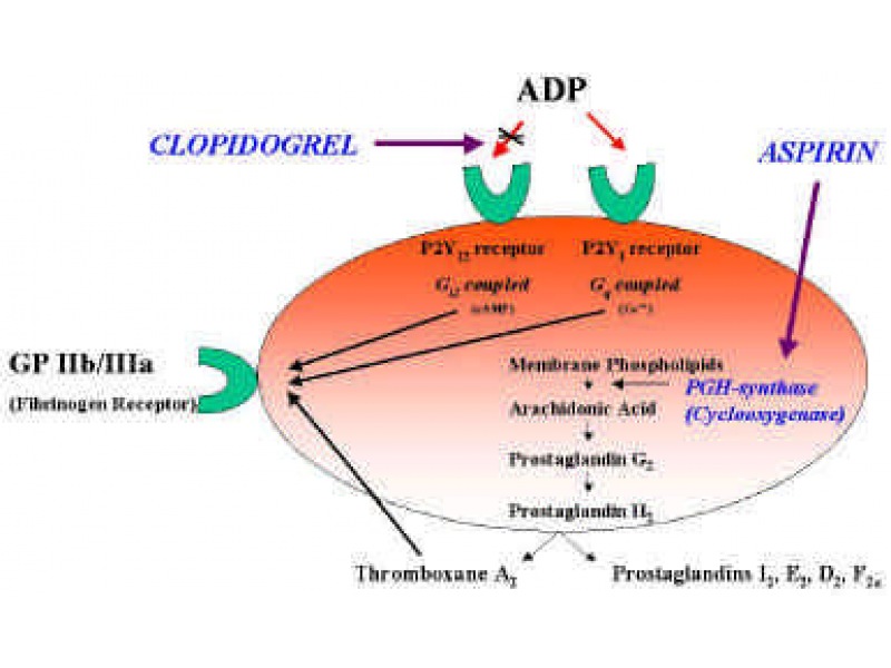 Aspirin vs Plavix (Clopidogrel Bisulfate), use San Qi (Notoginseng) to replace them when people have severe side effects from these drugs